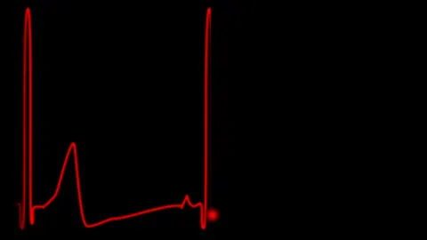 Shapes pulsing to a beat you can almost hear.
