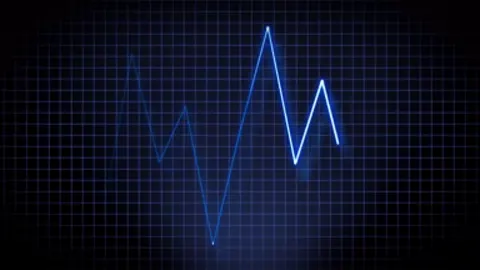 A blue ECG line pulsing across a dark monitor.